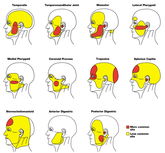 Orofacial