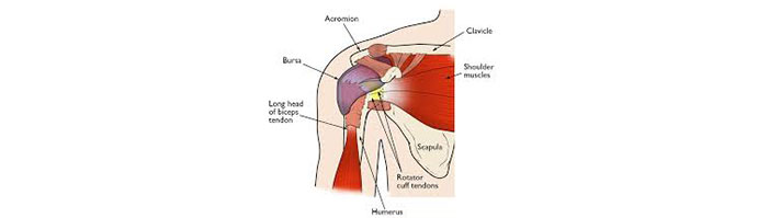 Rotator-Cuff-Conditions