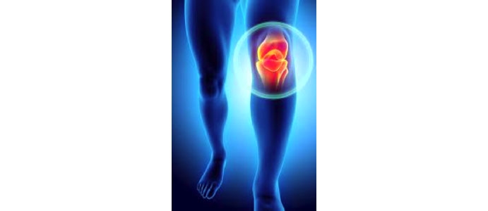 Image depicting a person finding relief from knee pain with the guidance of a specialist